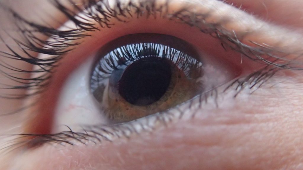 Cuál es la enfermedad tiroidea que afecta la salud de los ojos y cómo reconocer sus señales de alerta