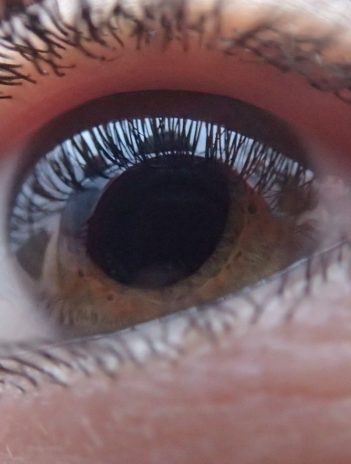 Cuál es la enfermedad tiroidea que afecta la salud de los ojos y cómo reconocer sus señales de alerta