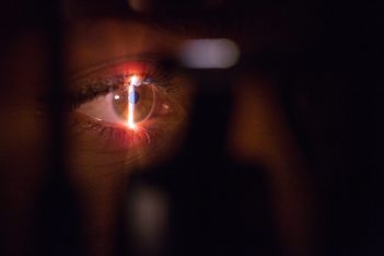 Hipermetropía: causas, síntomas, diagnóstico y tratamiento
